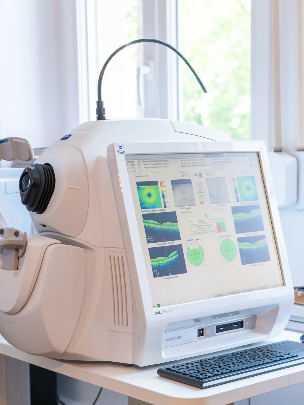 OCT-Gerät für den hochauflösenden Netzhautscan